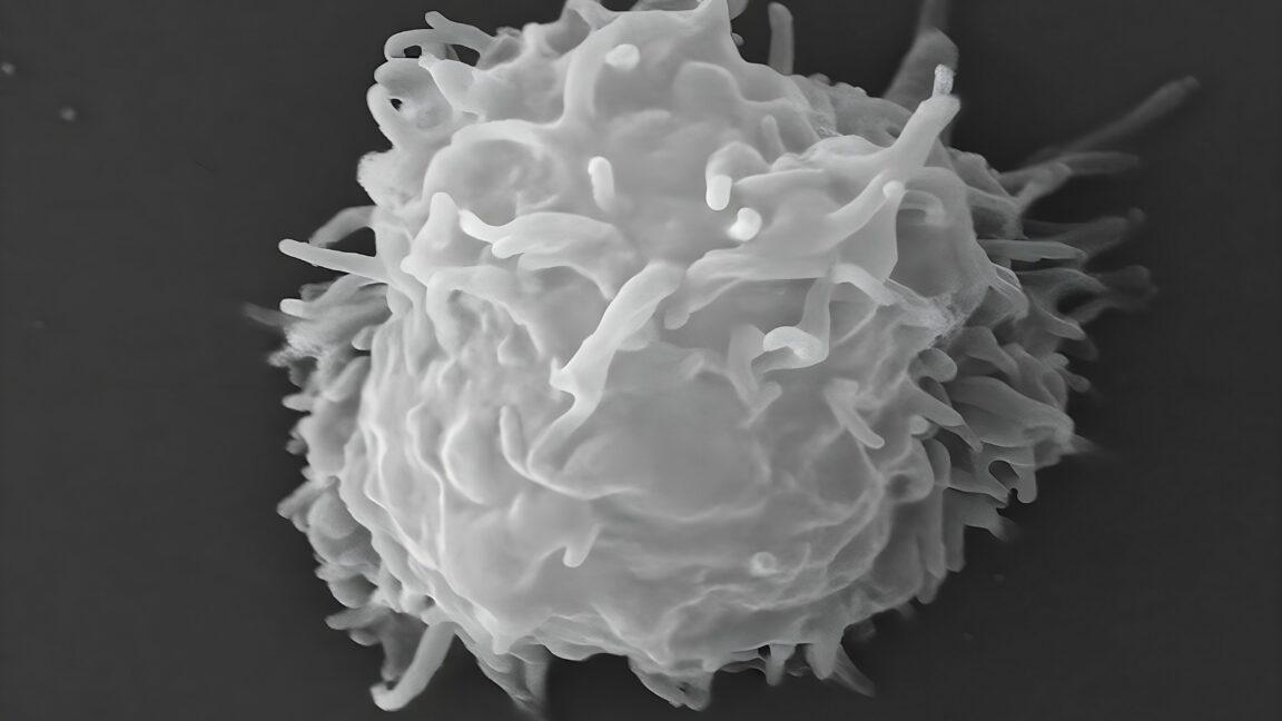 Man dies covered in necrotic lesions after amoebas eat him alive