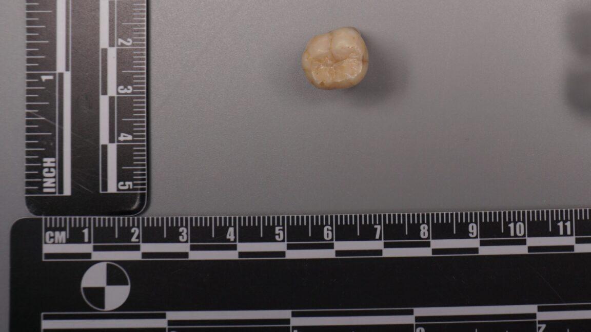 Protein in Homo erectus teeth suggests Denisovans gave us some of their DNA