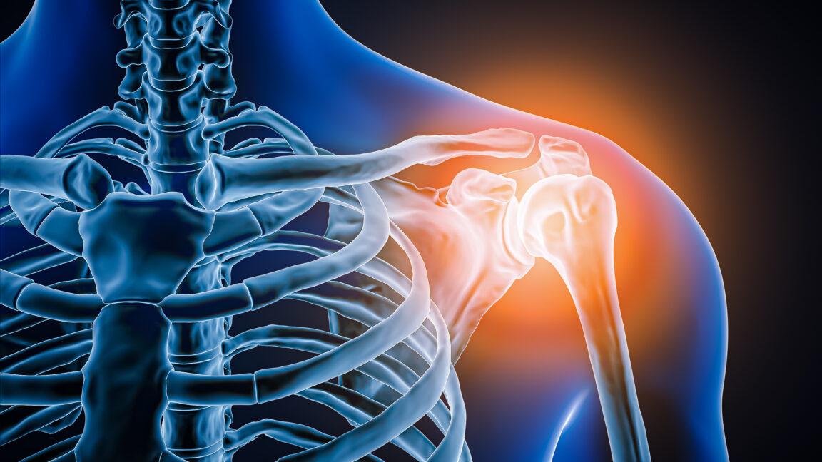 Doctors took a look at man's painful shoulder—they found the joint was missing